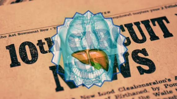 10th Circuit Ocaliva News headline featuring a medicated liver