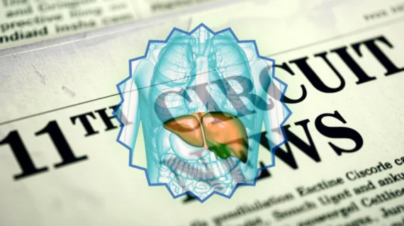 11th Circuit Ocaliva News headline featuring a medicated liver
