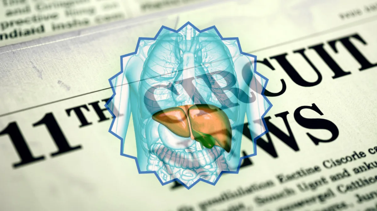 11th Circuit Ocaliva News headline featuring a medicated liver