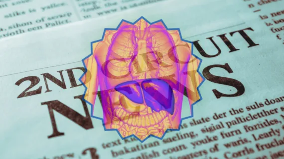 2nd Circuit Ocaliva News headline featuring a medicated liver