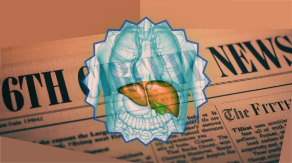 6th Circuit Ocaliva News headline featuring a medicated liver