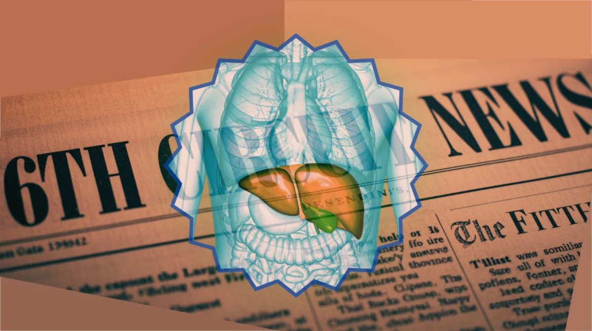 6th Circuit Ocaliva News headline featuring a medicated liver