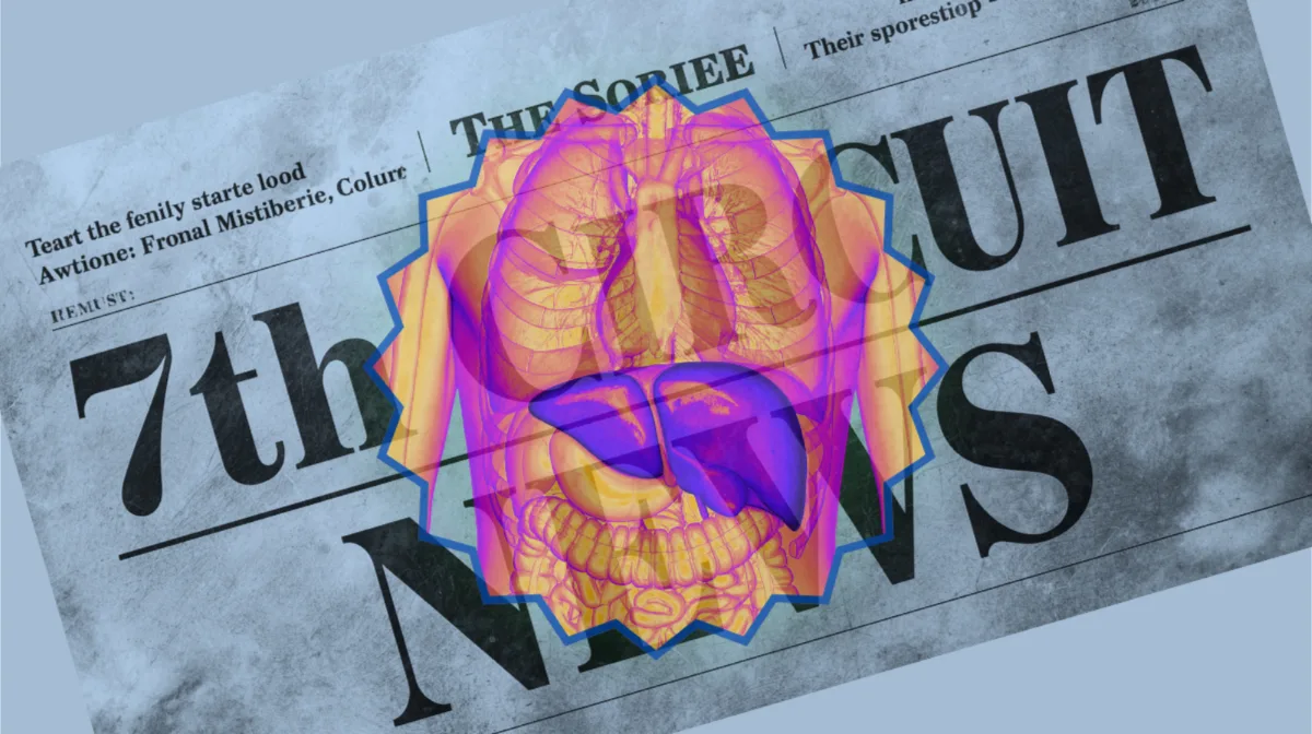 7th Circuit Ocaliva News headline featuring a medicated liver