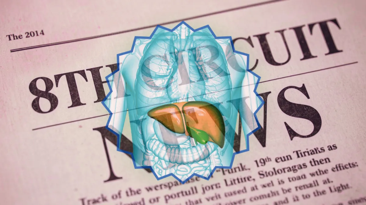 8th Circuit Ocaliva News headline featuring a medicated liver